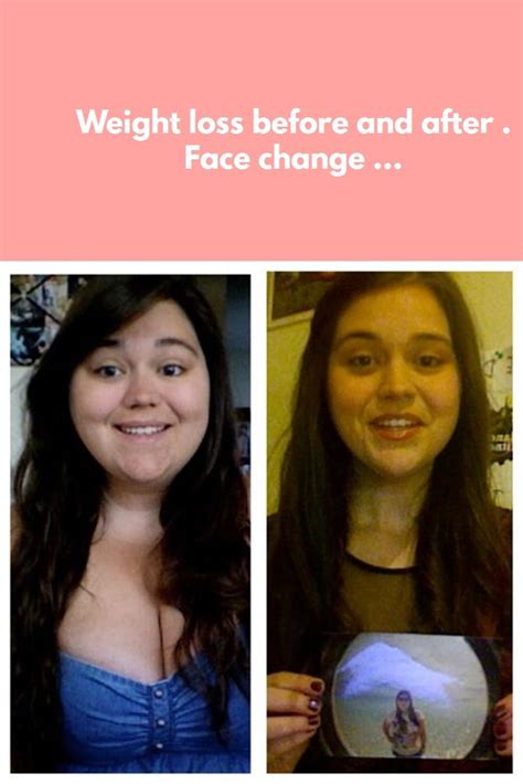 Pin On Weight Loss Before And After Face