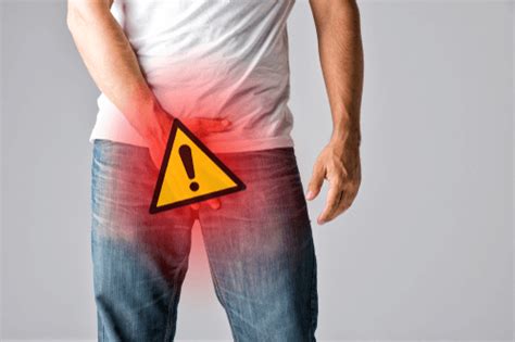 Jock Itch Facts Causes Symptoms Treatment