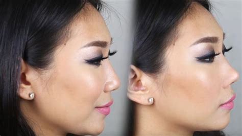 Nose Lifter Before And After Photos Plastic Hook Gives You A ‘nose Job
