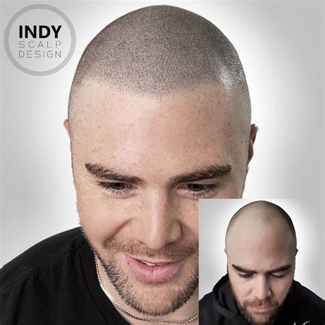 indy scalp design