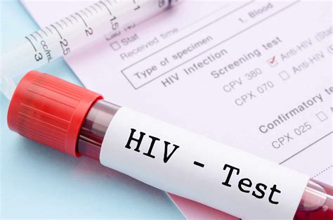 Hiv Test Types Procedure Importance And Results Dr Lal