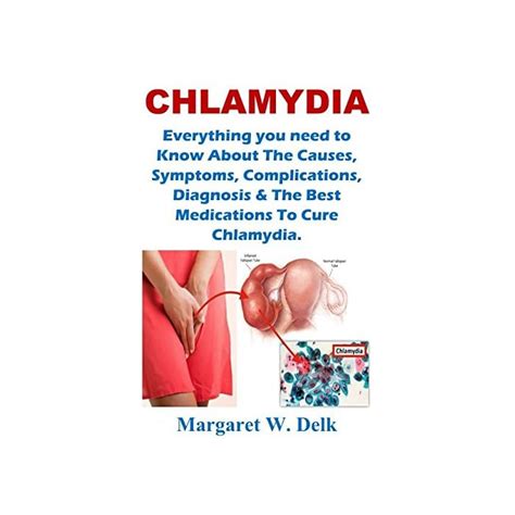Buy Chlamydia Everything You Need To Know About The Causes Symptoms