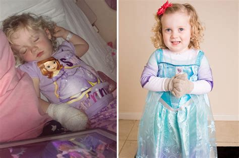 Meet The Real Life Elsa From Frozen Tot Suffers From