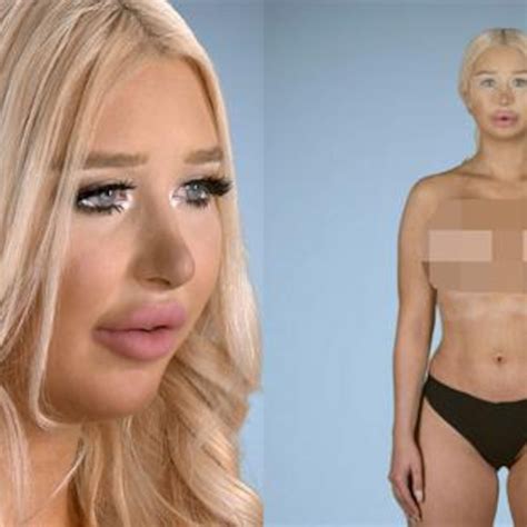 plastic surgery almost killed amanda e online