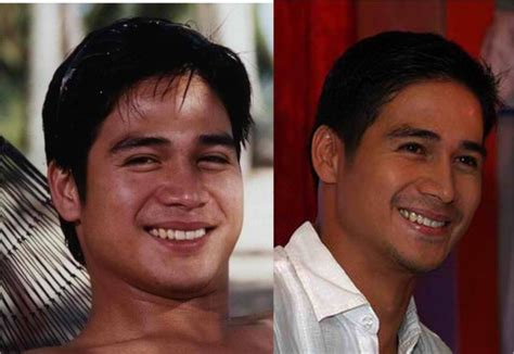 Piolo Pascual Before And After Of Pinoy Celebrities