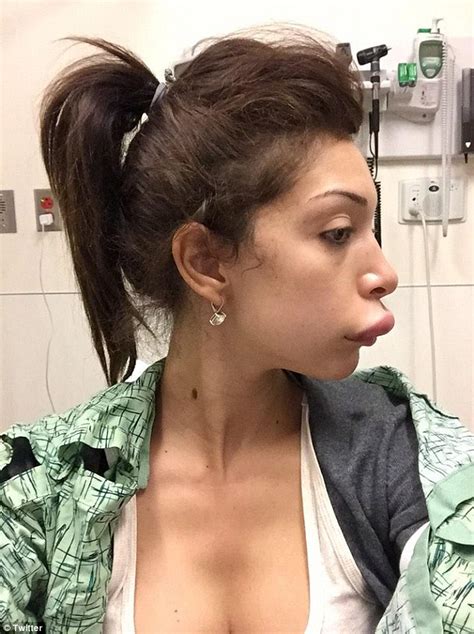 teen mom s farrah abraham in the er after her lip injections take a bad turn daily mail online