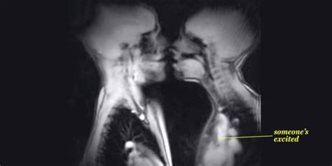 Mri oral sex