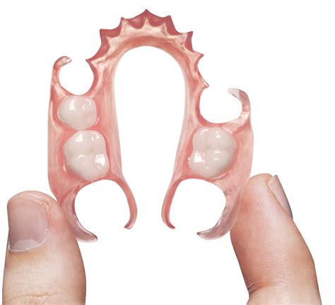 flexible partials hardin dental lab