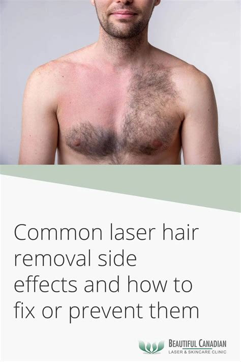 common laser hair removal side effects    fix  prevent
