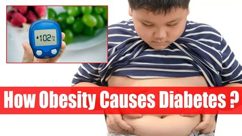 how obesity causes diabetes obesity and diabetes free diabetes
