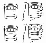 Urine Urinalysis sketch template