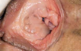 Far hairy pussy lips