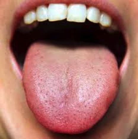 tongue tells  selby acupuncture