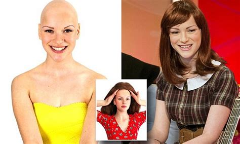 alopecia is a big part of my life but it doesn t define me teenager