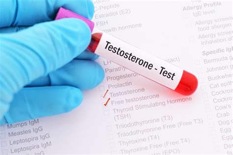 Testosterone Deficiencies Common In Men With Hepatitis C