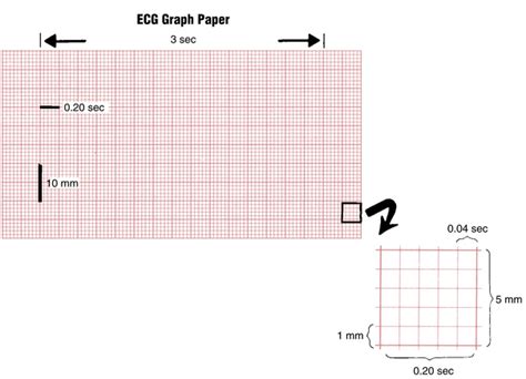 Ecg Basics Waves Intervals And Segments Thoracic Key