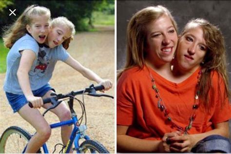 What Famous Conjoined Twins Abby And Brittany Hensel Are