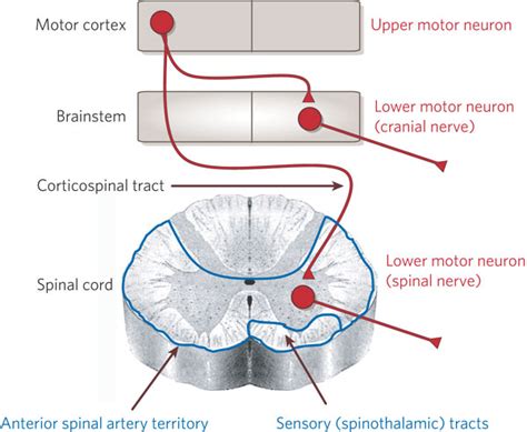 lesions  upper motor neurons   motor neurons medchrome