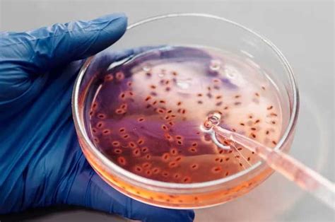 kandungan bakteri  coli ditemukan tinggi  sumur warga yogyakarta dlh himbau mengolah air