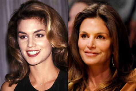 Cindy Crawford Photos Celebs Who Had Plastic Surgery Or Didn T