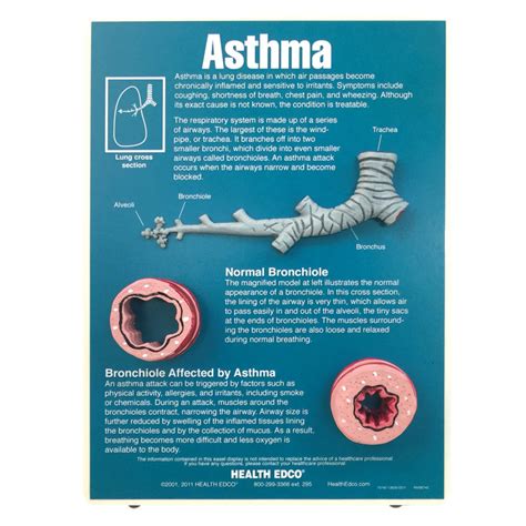 asthma easel display for health education health edco