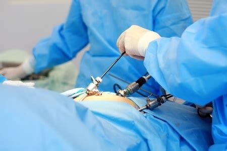 laparoscopy indore infertility clinic