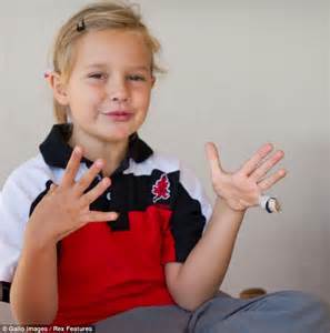 Girl 8 Has Finger Amputated After Being Bitten By Tiger While