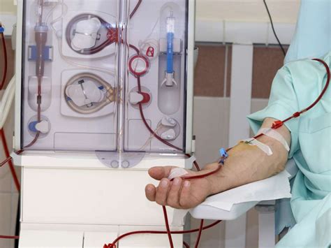 dialysis procedure purpose types side effects