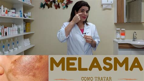 melasma como tratar existe tratamento para o melasma no rosto saiba os cuidados que deve se