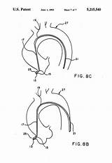 Coronary Catheter Right Patents Claims sketch template