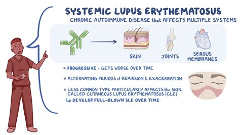 pathophysiology  systemic lupus erythematosus