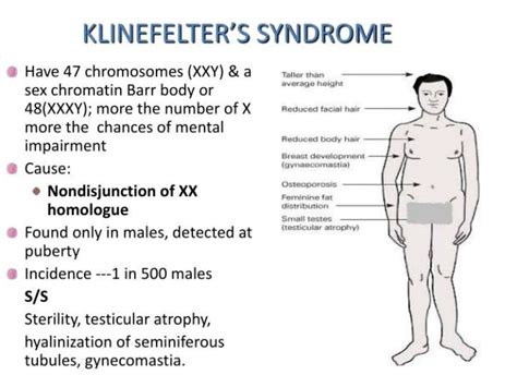 have you ever heard of klinefelter syndrome girlsaskguys