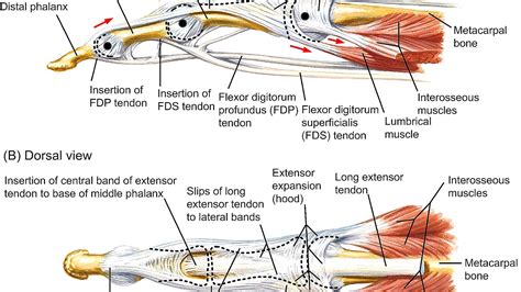 central slip extensor tendon injury injury choices