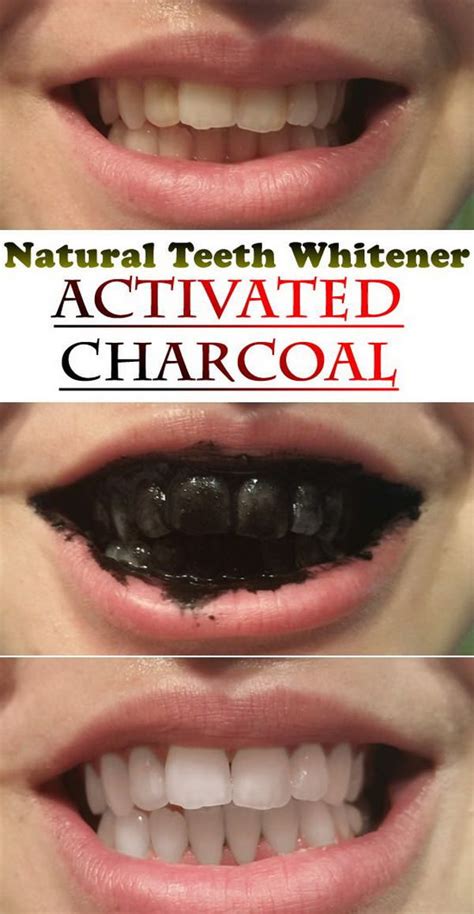 15 natural ways to whiten your teeth homemade teeth
