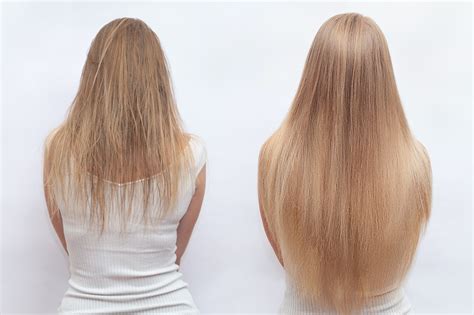 pureauty naturals scalp serum      growing hair