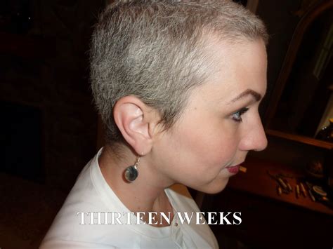 Anncredible Hair Growth Progression After Chemo Six