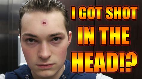 I Got Shot In The Head By A Gun Youtube