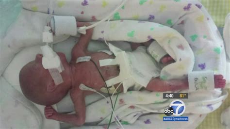 identical twins in washington could have birthdays 4 months apart