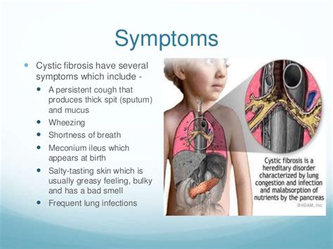 Cystic Fibrosis Pfc Ofori Addo