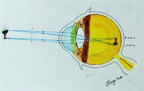 schematic eye  reduced eye optography