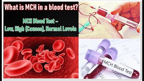 mch blood test  high  normal levels youtube