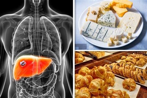 non alcoholic fatty liver disease diet avoid 9 foods to reverse