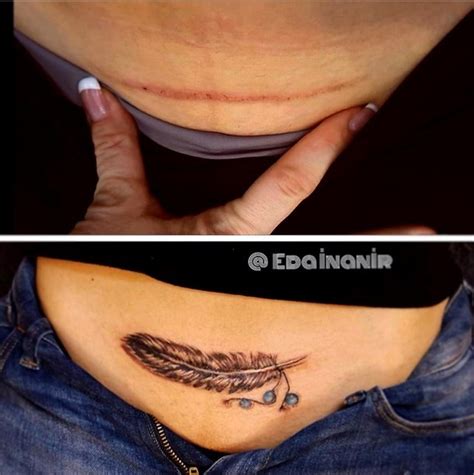 C Section Tattoos Mums Reveal Caesarean Scar Body Art Madeformums