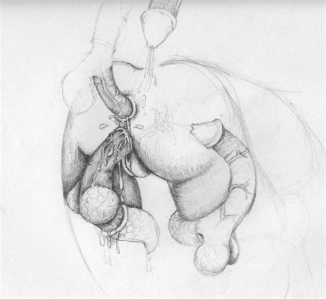 474px x 435px - Pencil Drawing Erotic Art Cum 2581 | Hot Sex Picture