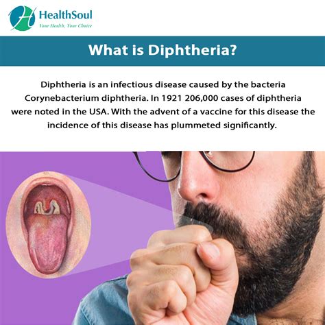 diphtheria symptoms and treatment internal medicine healthsoul
