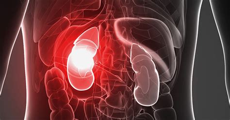 renal failure acute renal failure overview   periodic dialysis  terminal uremia