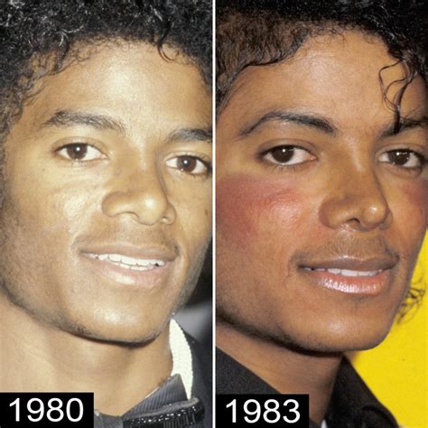 michael jacksons plastic surgery   transformation
