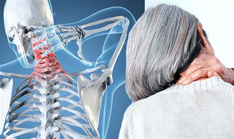 arthritis    symptoms       identify neck