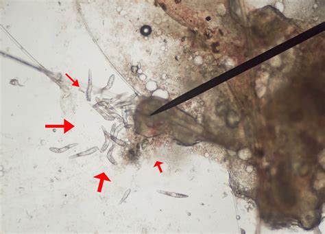 demodex mites  microscope demodectic mange