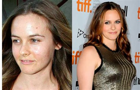 30 Shocking Pics Of Celebs With No Make Up Relationship Surgery